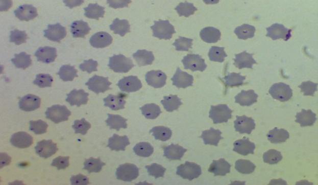 Fig 3.2: - Thin blood smear showing the piroplasm stage of T.