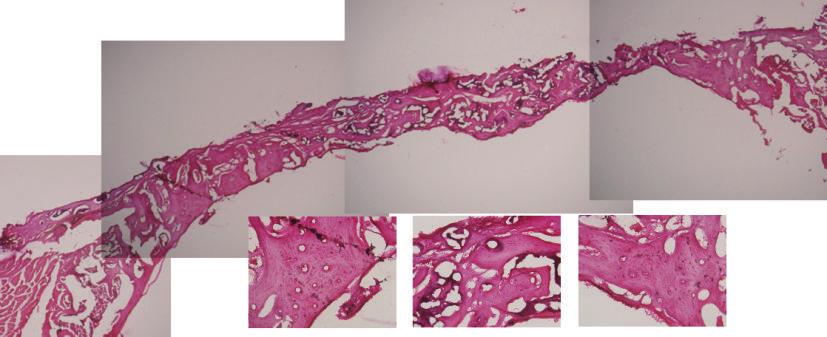 The amount of bone regeneration in the rats is higher in the ES group than in the non-es group (ITF: interface; : new bone; HB: host bone; FBC: foreign body capsule; original magnification: 40).