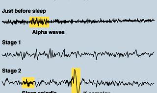 EXAMPLES OF EEG ACTIVITY - Awake: low voltage, random, fast beta waves - Drowsy: 8-12 Hz alpha waves - Stage 1: 3-7 Hz theta waves - Stage 2: 12-14 Hz (Sleep spindles, K complexes) - Stage 3 and 4: