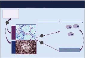 HCV infection 1 Islet cells Thyrocytes HCV-driven organ-specific autoimmunity thyroiditis and type 2 diabetes 2 3 Autoreactive amplification loop CXCL 10 Chemotaxis Stimulation of CXCL 10 secretion