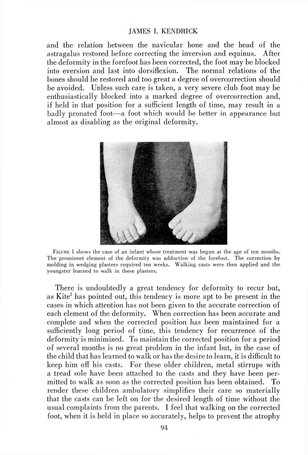 JAMES I. KENDRICK and the relation between the navicular bone and the head of the astragalus restored before correcting the inversion and equinus.