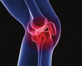 State of the Science By Patience H. White, MD, MA, and Mary Waterman, MPH Making Osteoarthritis a Public Health Priority Several initiatives are placing this chronic illness on the national agenda.