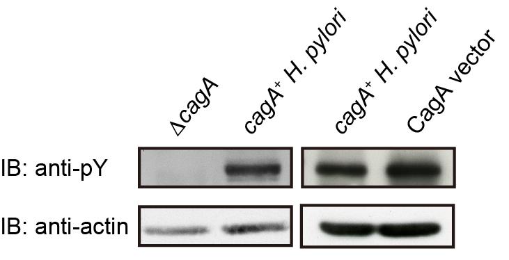 Supplementary Figure S8. Comparison of the levels of infected CagA and transfected CagA in AGS cells. (left) AGS cells were infected with H.