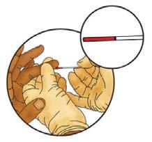 Disinfect the puncture site with an alcohol swab or appropriate disinfectant. Slide 35 Finger Prick Make a gentle prick with a sterile lancet at the disinfected site.
