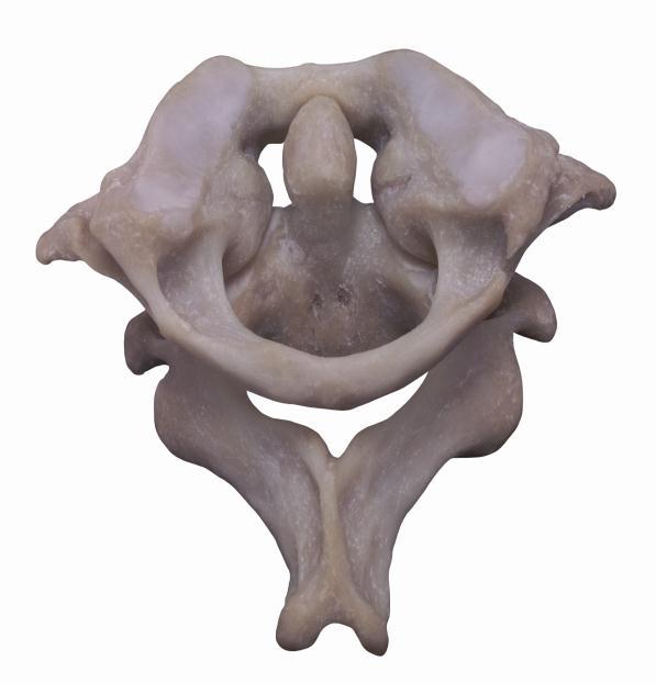 cervical vertebrae One