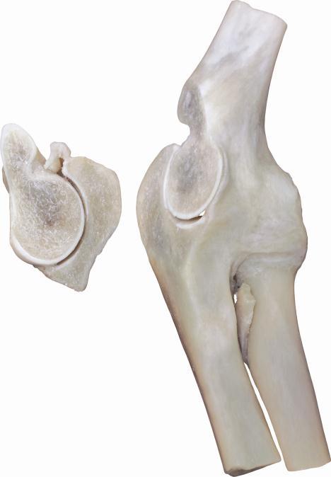 S L049 The joints of hand Ligaments dissected,