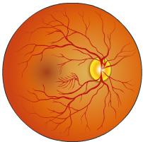 Blood flows to the retina through small blood vessels. Diabetic Retinopathy People with diabetes are more likely to develop eye problems than people who do not have diabetes.