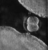 Fertilization Progesterone from granulosa cells causes enzymes in acrosome to leak out and dissolve matrix around egg One Sperm binds to zona pellucida