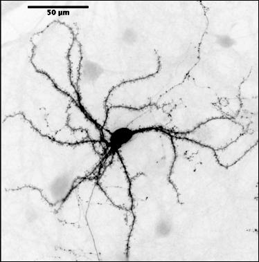 Medium Spiny Neurons In
