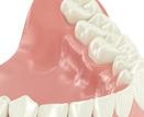 Replacing all your teeth: Is your denture uncomfortable?