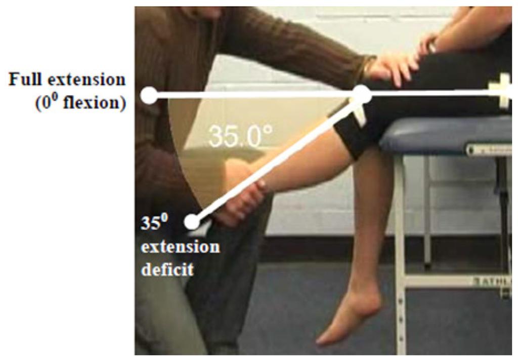 The figure shows normal anatomical range of 135 knee flexion (6) and the maximum amount of knee flexion ROM that is permissible
