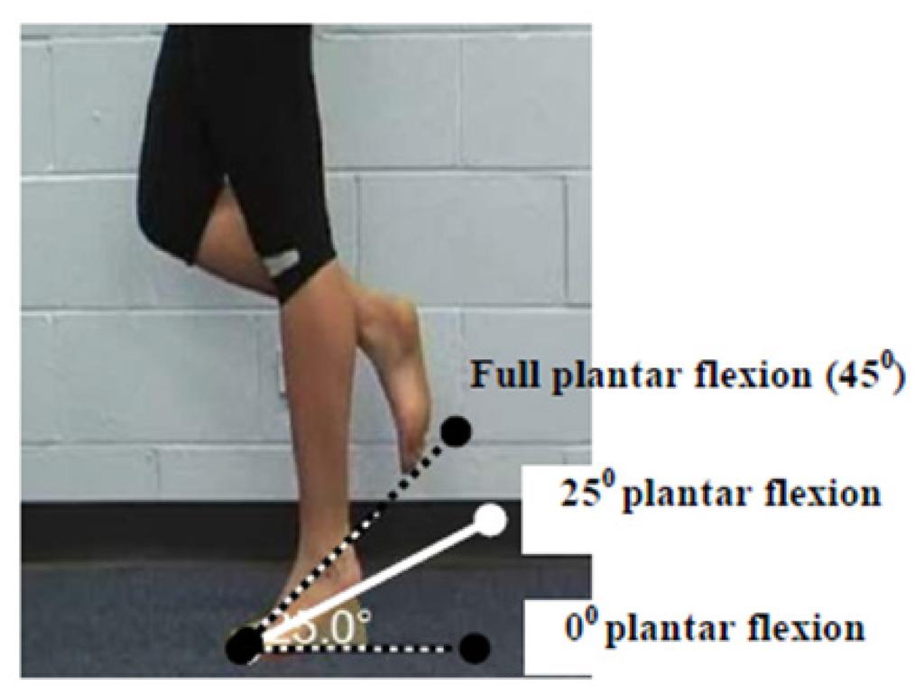 Primary Criterion #6 Ankle plantar flexion loss of 3 muscle grade points (muscle grade of two).