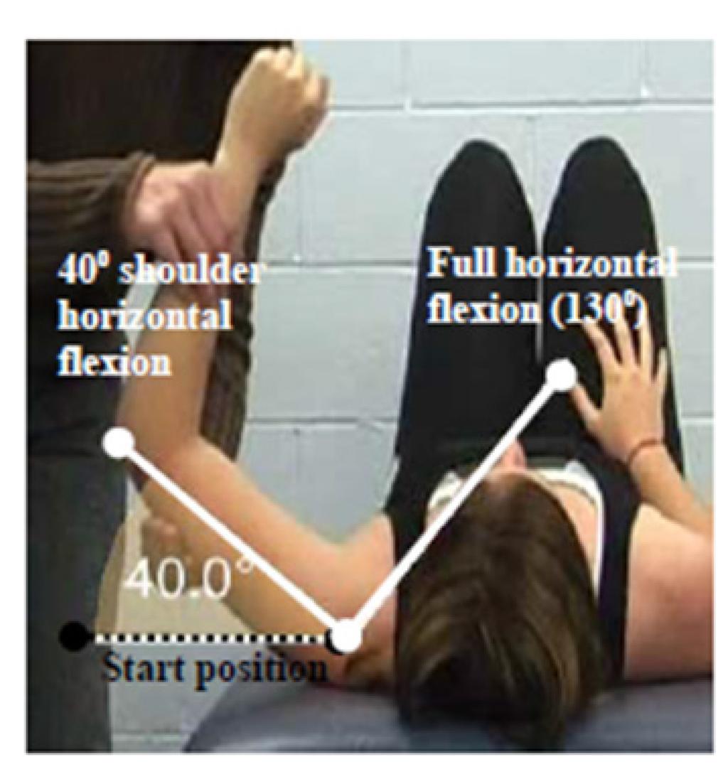 2.2.2 MDC for Bilateral Upper Limb Impairment For athletes with bilateral upper limb impairments, BOTH upper limbs must separately meet the MDC as outlined in 2.2.2.1, 2.2.2.2, or 2.2.2.3. 2.2.2.1