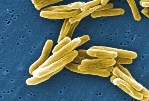 Introduction TB is an airborne disease caused by the bacterium Mycobacterium tuberculosis (M. tuberculosis) (Figure 2.1). M. tuberculosis and seven very closely related mycobacterial species (M.