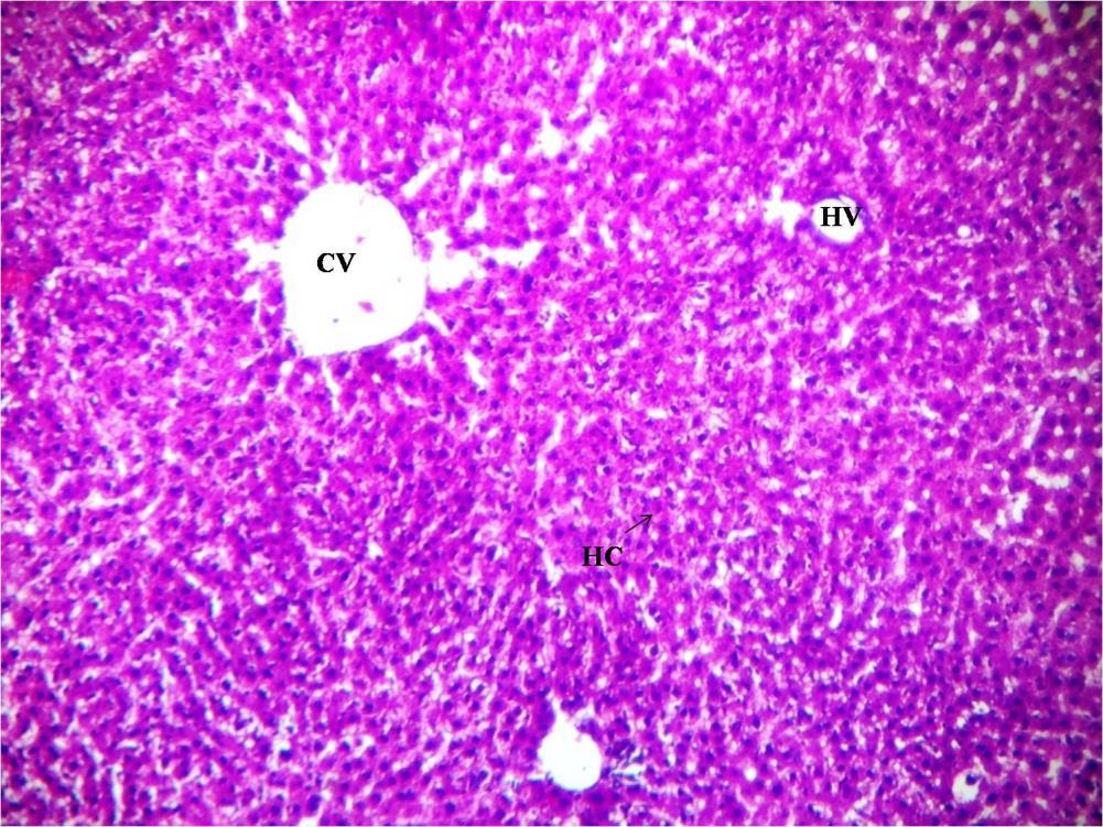 Figure 2: shows liver of control mice with distinct hepatic cells,