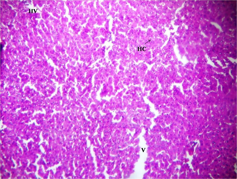 Figure 6: shows liver of diabetic mice followed by eight weeks administration of Withania somnifera with