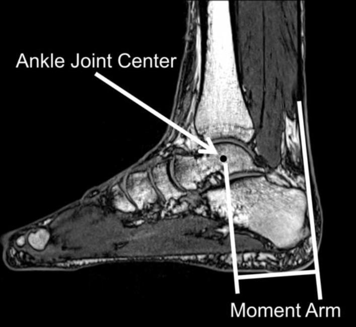 The ankle joint permits movement in a variety of directions but the greatest ankle joint 2 moments are produced during plantar flexion because the plantarflexor muscles (calf muscles) are the most
