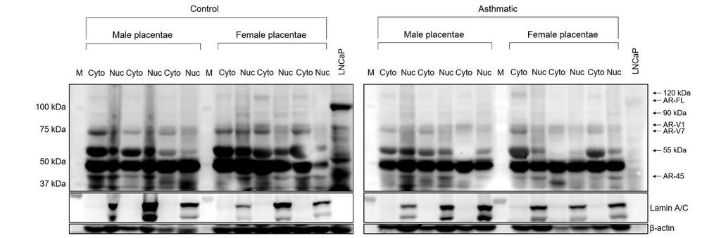 The human placenta expresses multiple AR isoforms Seven protein bands