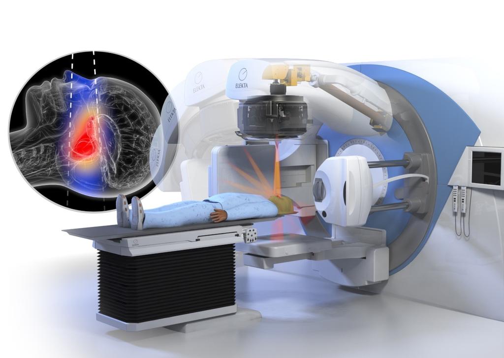 CLINICAL ADVANTAGES Icon is the latest generation of Gamma Knife technology.