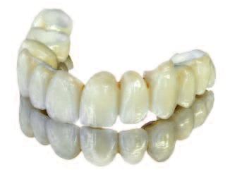Zirconium oxide is presently the strongest all-ceramic available for dental applications. It is additionally characterized by excellent biocompatibility and low heat conductivity.