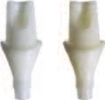 Therefore, your dental laboratory can fabricate an indirect IPS e.max restoration for the abutment, for example, using lithium disilicate.