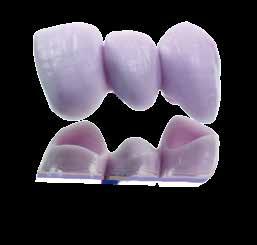 max CAD is also suitable for use in the fabrication of three-unit anterior and premolar bridges.