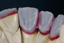 esthetic restorations in a very efficient manner. Fully anatomical wax-up.