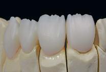 dentist (shade selection), which serves as the optimum basis for a