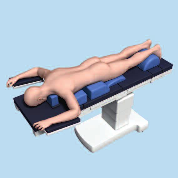 Patient Positioning Position the patient prone on the operating table, with the lumbar spine in a neutral position. Use a standing plain film to establish the appropriate spinal alignment.