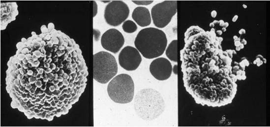 Mast Cell Degranulation Orr. TSC in Slide Atlas of Immunology; Roitt et al,, ed. 1991.