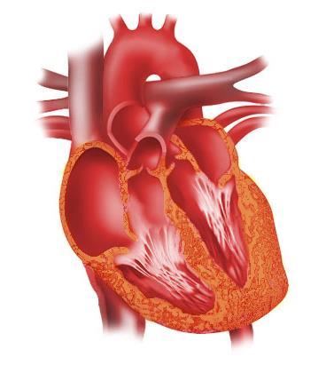The Heart Heart RA - Right