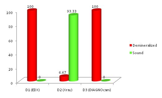 chart 2: Results obtained in Group II after 72 hours of demineralization.