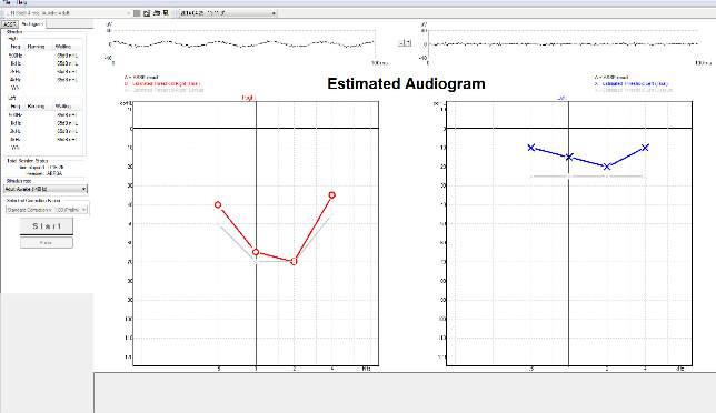 Eclipse Additional Information Page 140 The Audiogram tab This screen shows the Estimated Audiogram (Right - Red & Left - Blue) based on the ASSR recordings.