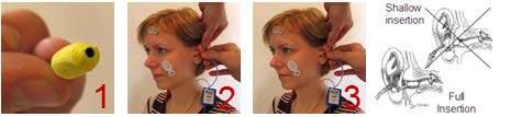 Eclipse Additional Information Page 148 Electrode placement After having prepared the skin, place an electrode on each mastoid or earlobe (blue electrode lead on left side, red on right side) one at