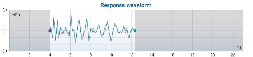 Response waveform graph The TE response waveform graph shows the two superimposed averaged OAE waveforms (in light blue and purple).