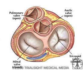part of left aortic sinuses
