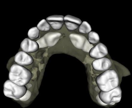 Whether your teeth are slightly misaligned or you need extensive corrective treatment, 3D imaging can play a vital role.