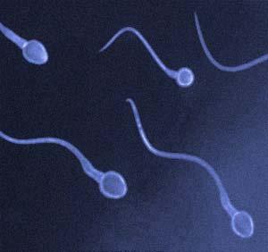 Spermatozoon Head Acrosome: enzymes Tail