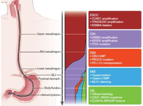 Oesophageal Cancer - Biology Gradations of molecular subclasses of gastro-oesophageal carcinoma CIMP, CpG island methylator phenotype; EBV, Epstein-Barr Virus; ESCC, oesophageal