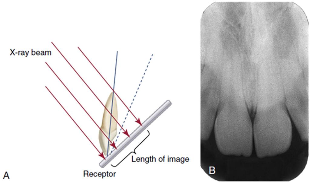 Foreshortened Images From Iannucci J, Jansen Howerton L: Dental radiography: principles and