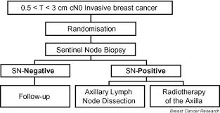 SNB+: radioterapia axilei sau limfadenectomie?