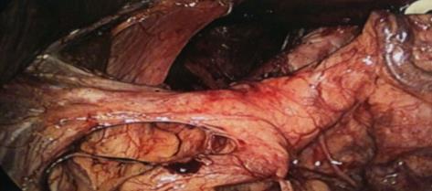 Pancreas Program OBJECTIVES Anatomical considerations Indications Contraindications Operative treatment options Imaging