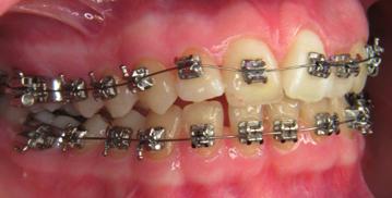 Experienced dental practitioners provided inspiration and advice for the development of SMILE.