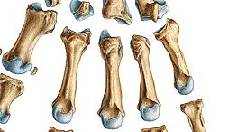 Ossa metacarpi (metacarpal bones I.-V.) I. V. II. III. IV. BASE - Basis ossis metacarpalis (III.
