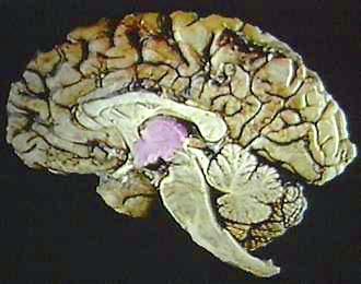 Gyrus (Primary sensory cortex).