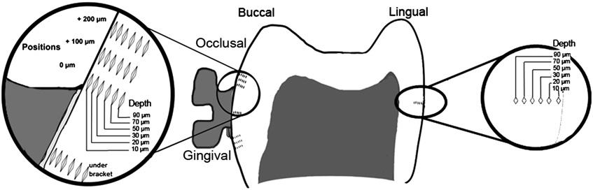 582.e2 Uysal et al American Journal of Orthodontics and Dentofacial Orthopedics May 2010 Fig. Diagram of positions and depths of indentations. eruption.