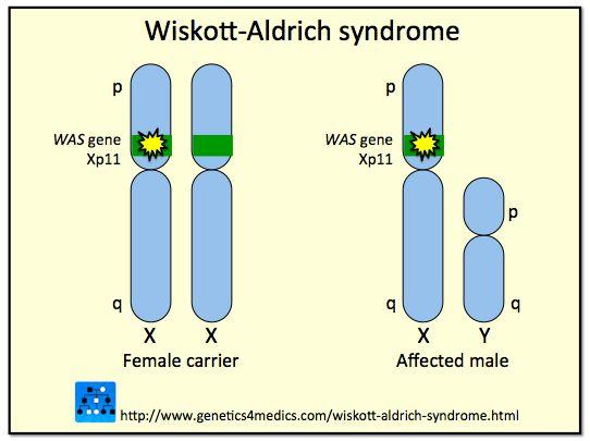 Wiskott-Aldrich syndrome The syndrome is caused by mutations in an X-linked gene encoding Wiskott-Aldrich syndrome protein (WASP).