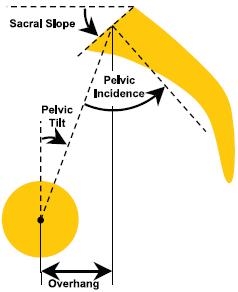 Pelvic measures Sacral slope (SS)