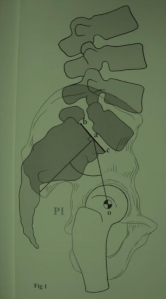 Pelvic incidence Key parameter Perpendicular to: the middle of the