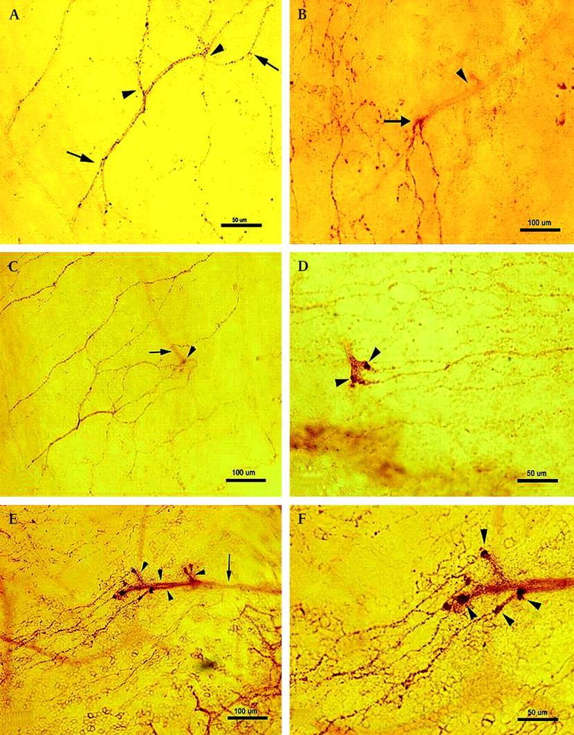 Figure 1.2 Corneal innervation. Photomicrographs of whole human corneal mount stained by the acetylcholinesterase technique.
